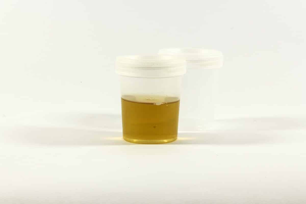 découvrez tout ce que vous devez savoir sur l'urine de chien, ses causes, ses effets sur la santé et comment gérer au mieux cette situation courante. obtenez des conseils pratiques pour prévenir les problèmes liés à l'urine de votre chien.